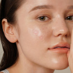  ISNTREE Патчи с красным луком точечные от воспалений onion newpair spot patch, 24 шт